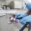 Indicator biologic sterilizare abur (autoclav) - GEOBACILLUS STEAROTHERMOPHILUS ATCC 7953
